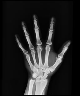 X-ray image representing calcium