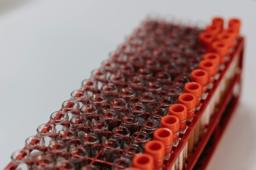 Blood sample tubes representing iron