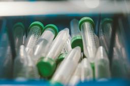 Laboratory tubes representing zinc